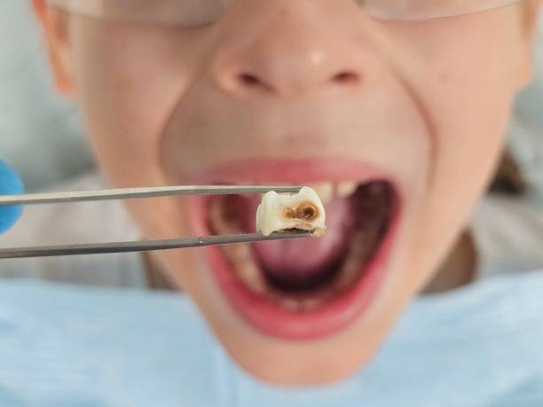 Best Emergency Dental Services for Seniors in Bigfork, MT